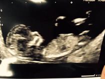 Any sex guesses please?