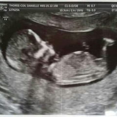 Best shit place grads # 2- still pregnant after miscarriage