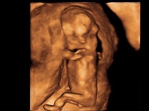 Guess our baby's gender!
