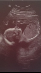 Girl or boy?