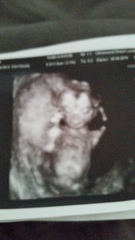 October baby bus take 3- booking in appointments and scans, here we come!