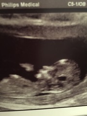 Nasal bone visible? Opinions appreciated