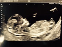 Any sex guesses please?