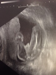 Girl or boy?