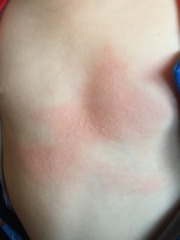 What could this rash be