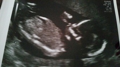 October baby bus take 3- booking in appointments and scans, here we come!