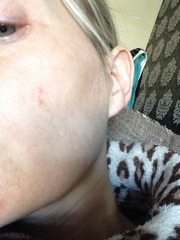 Help sort my skin (pics included)