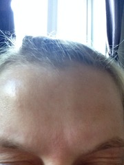 Help sort my skin (pics included)