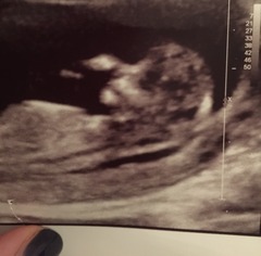 Nasal bone visible? Opinions appreciated