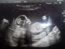 October baby bus take 3- booking in appointments and scans, here we come!