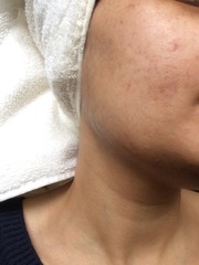 What can you tell me about my skin? (Pics included)