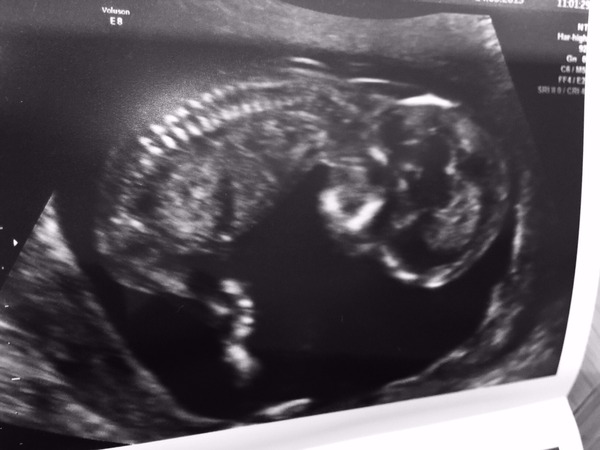 November 2015 mums to be! Here we are! Our bus is decorated with scan pics, our appetites are beginning to heal, and spring is in the air!