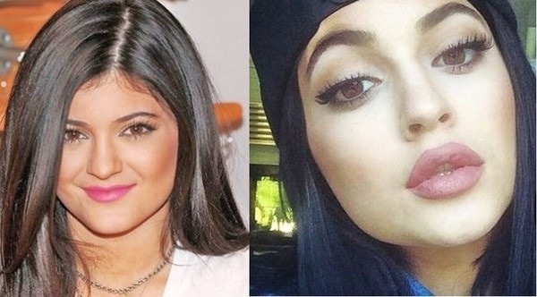 to think 'omg there's something WRONG with her FACE' when I see so many American actresses