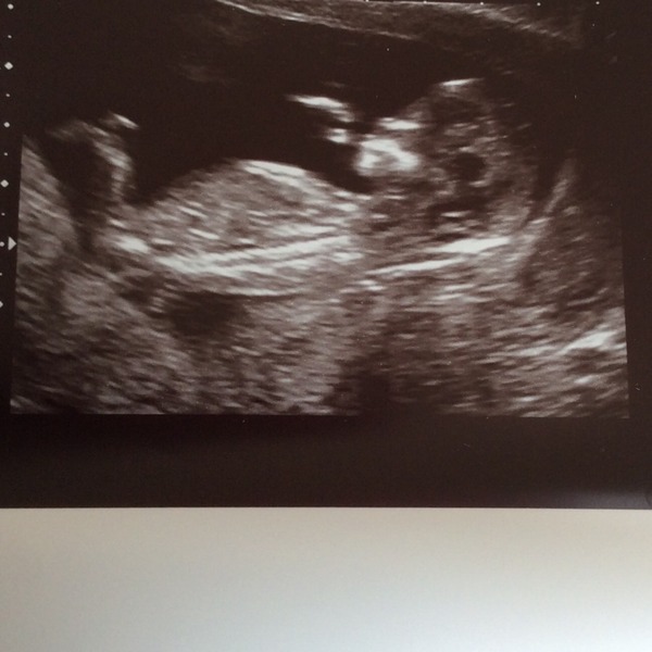 November 2015 mums to be! Here we are! Our bus is decorated with scan pics, our appetites are beginning to heal, and spring is in the air!