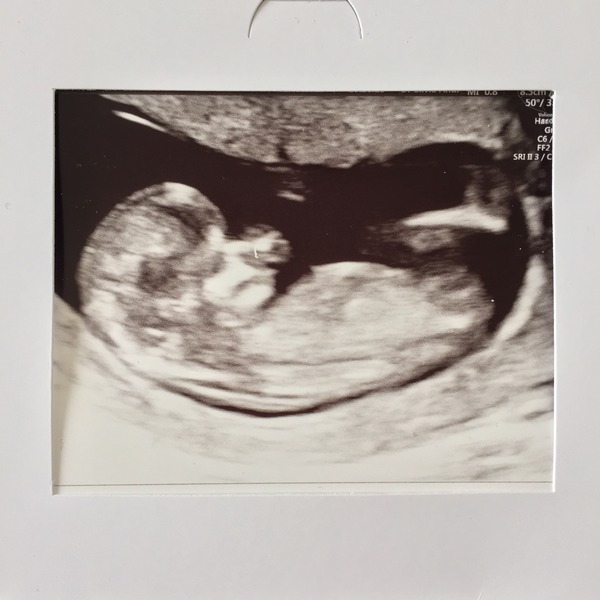 November 2015 mums to be! Here we are! Our bus is decorated with scan pics, our appetites are beginning to heal, and spring is in the air!