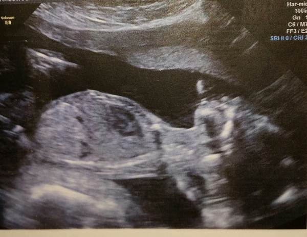 October baby bus take 4! 20wk scans and big pram buying plans!