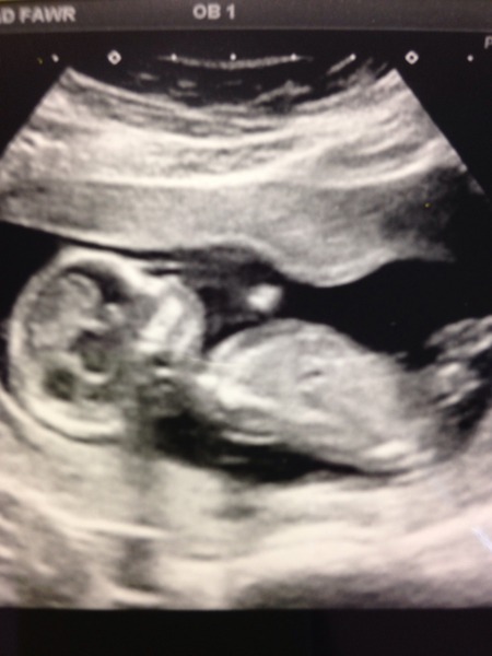 November 2015 mums to be! Here we are! Our bus is decorated with scan pics, our appetites are beginning to heal, and spring is in the air!