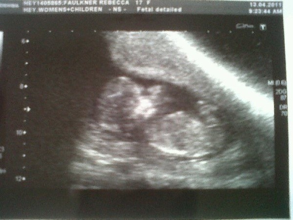 Just for fun... BOY OR GIRL?!