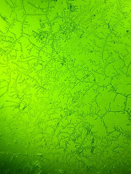 BUMSNET - where bums (and hopes) are raised in the quest for a BFP.