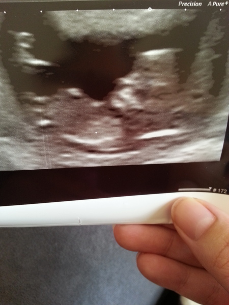 November 2015 mums to be! Here we are! Our bus is decorated with scan pics, our appetites are beginning to heal, and spring is in the air!