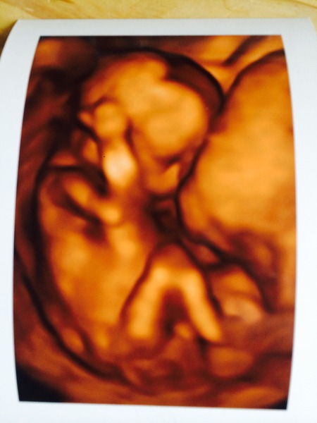 16 week sex scans - how accurate?