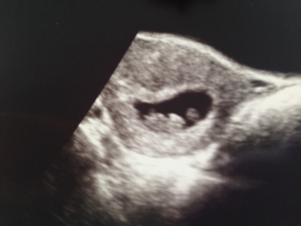 We're waving our poms poms and eating our magnums as we try not to lose control of our bladders. It's JS Grads 29!