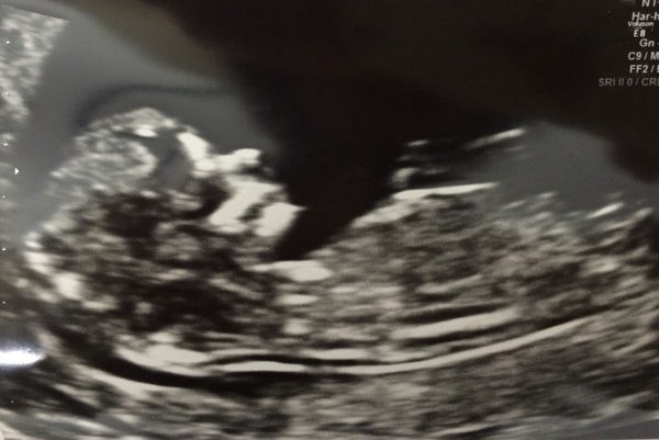 November 2015 mums to be! Here we are! Our bus is decorated with scan pics, our appetites are beginning to heal, and spring is in the air!