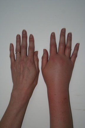 Swagger Inn: Thread 94 - Cumpleaños feliz! It's Santi's 37th birrrrthday...