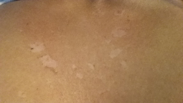 please help - spray tan gone wrong