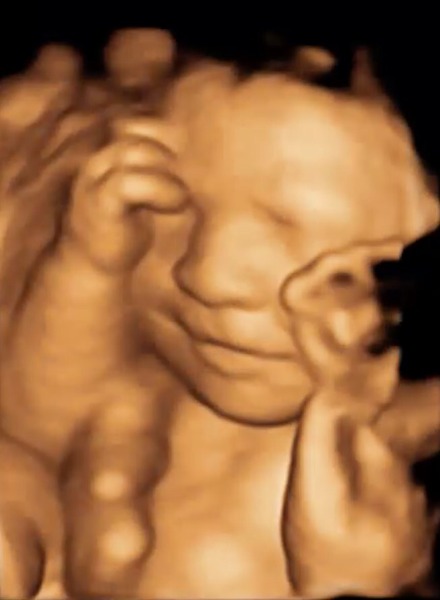 4D Scan recommendations in London??? Good deals??