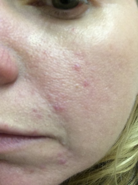 amazing faces-join our quiche and watch the years roll back!