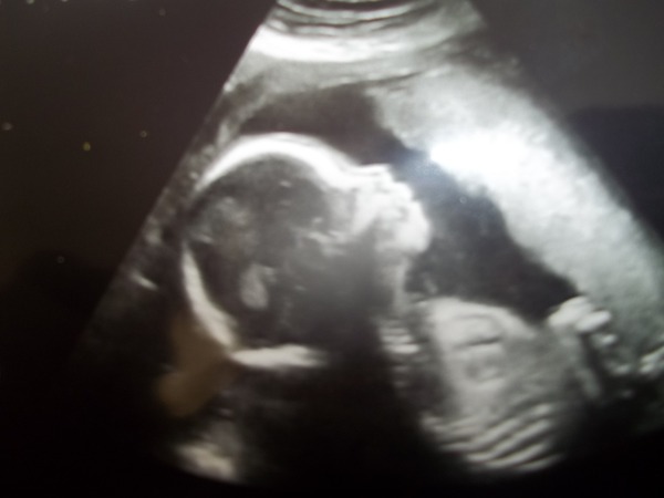 We're waving our poms poms and eating our magnums as we try not to lose control of our bladders. It's JS Grads 29!