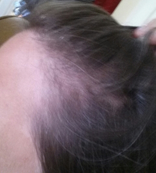 to have all my hair chopped off?