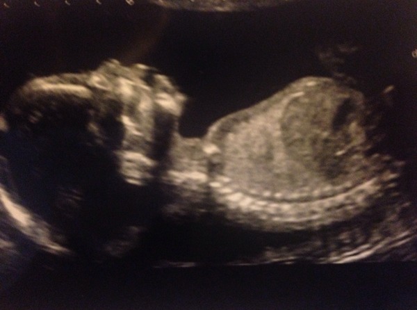 September crew - baby bumps are appearing and we're emerging as team blue, pink or yellow! Thread 8 :)