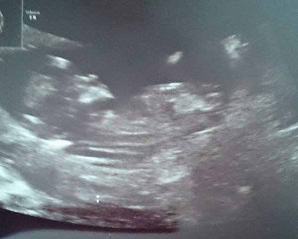 November 2015 mums to be! Here we are! Our bus is decorated with scan pics, our appetites are beginning to heal, and spring is in the air!