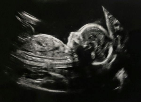 September crew - baby bumps are appearing and we're emerging as team blue, pink or yellow! Thread 8 :)