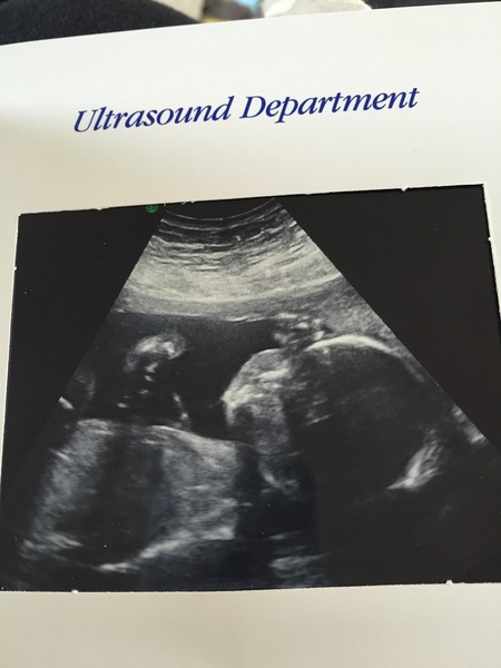 September crew - baby bumps are appearing and we're emerging as team blue, pink or yellow! Thread 8 :)