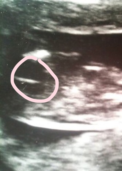 Gender guesses?! Nub theory?