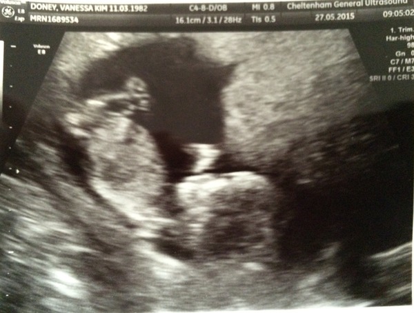 The angry pubes of bumsnet grad bus!