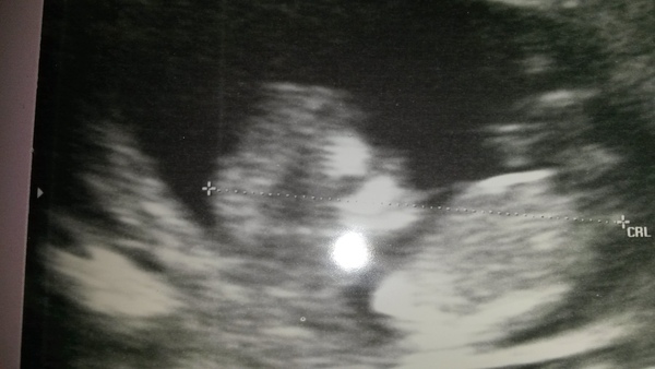 November 2015 mums to be! Here we are! Our bus is decorated with scan pics, our appetites are beginning to heal, and spring is in the air!