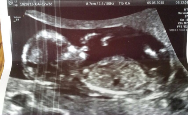 November 2015 mums to be! Here we are! Our bus is decorated with scan pics, our appetites are beginning to heal, and spring is in the air!