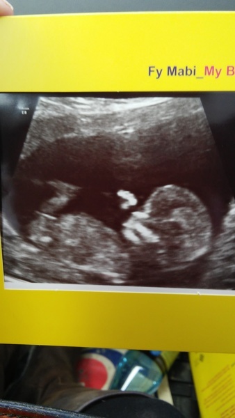 November 2015 mums to be! Here we are! Our bus is decorated with scan pics, our appetites are beginning to heal, and spring is in the air!