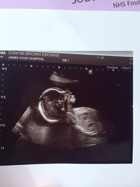 September crew - baby bumps are appearing and we're emerging as team blue, pink or yellow! Thread 8 :)