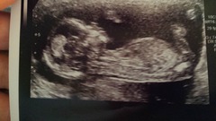 best shit place grass #3. Still pregnant and scans ahoy. End of the year can't come soon enough!