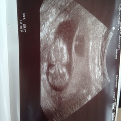 best shit place grass #3. Still pregnant and scans ahoy. End of the year can't come soon enough!