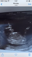 Scan at 14 weeks