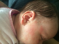Milk spots? Photos included