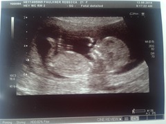 Just for fun... BOY OR GIRL?!