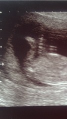 Baby gender theories.. Are they right?!