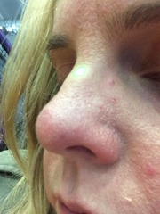 Why does my make up do this? With photo